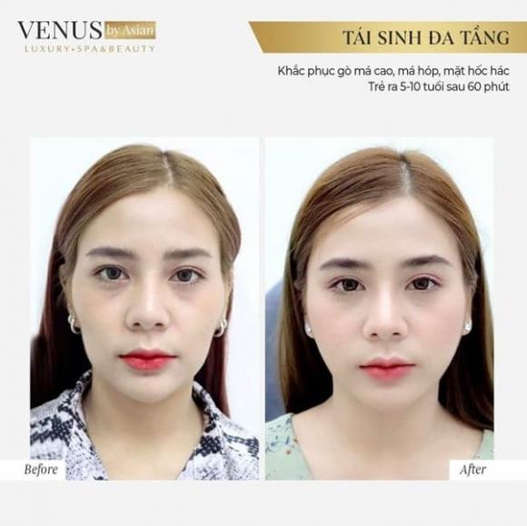 Phòng khám chuyên khoa Phẫu thuật tạo hình thẩm mỹ Venus, Venus by Asian, địa chỉ làm đẹp