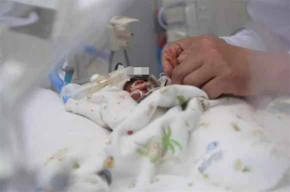 Interesting story, the world's smallest baby girl, born only 25 cm