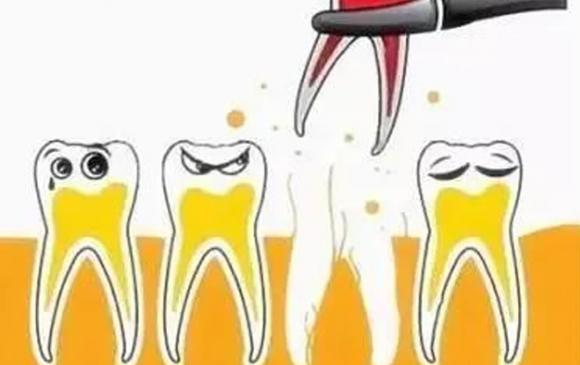 chết não sau khi nhổ răng, nhổ răng, lưu ý khi nhổ răng