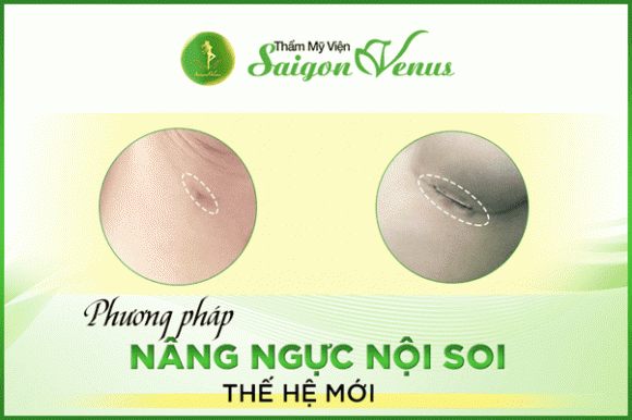 Hot girl Thúy Vy, Nâng ngực, Sài Gòn Venus
