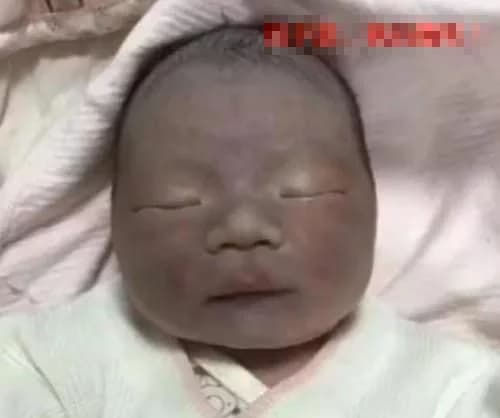 chăm sóc trẻ đúng cách, làn da trẻ đen thui, lưu ý khi sinh con