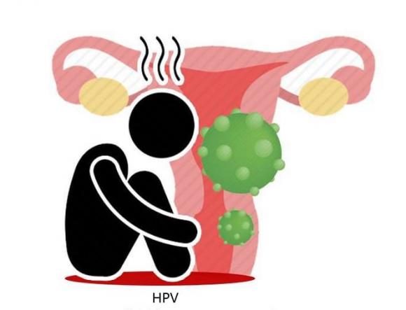 HPV, sức khỏe phụ nữ, bệnh phụ khoa, virus HPV