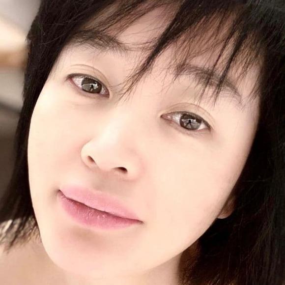 kim hye soo, đụng dao kéo, đôi môi, sao hàn 