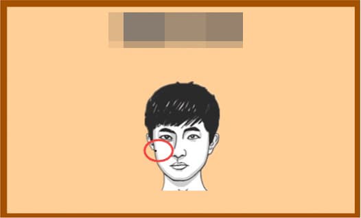 tử vi, nốt ruồi, nốt ruồi tốt