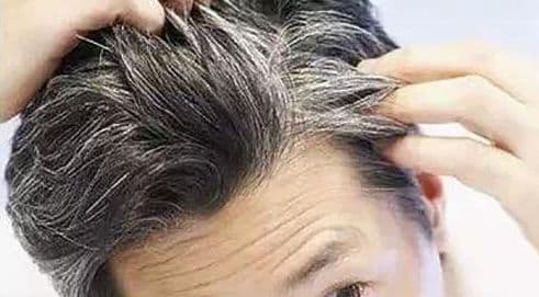 tóc bạc, tóc bạc là dấu hiệu tuổi già, dấu hiệu sức khỏe gặp vấn đề