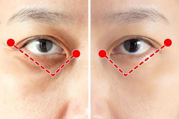 Học ngay bài tập 1 phút của người Nhật để xóa nếp nhăn quanh mắt
