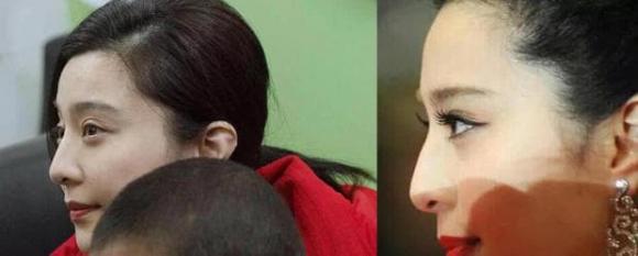 phạm băng băng, selfie phạm băng băng, phạm băng băng phẫu thuật thẩm mỹ