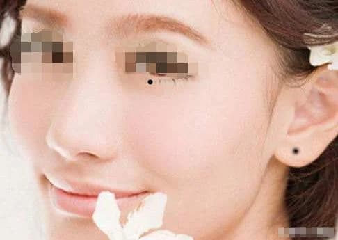 nốt ruồi, phụ nữ có nốt ruồi xui xẻo, nốt ruồi kém may