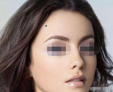 nốt ruồi, phụ nữ có nốt ruồi xui xẻo, nốt ruồi kém may