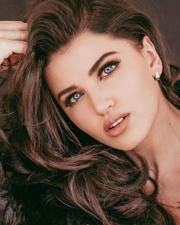 Hoa hậu Siêu quốc gia 2021, Miss Supranational 2021, Chanique Rabe