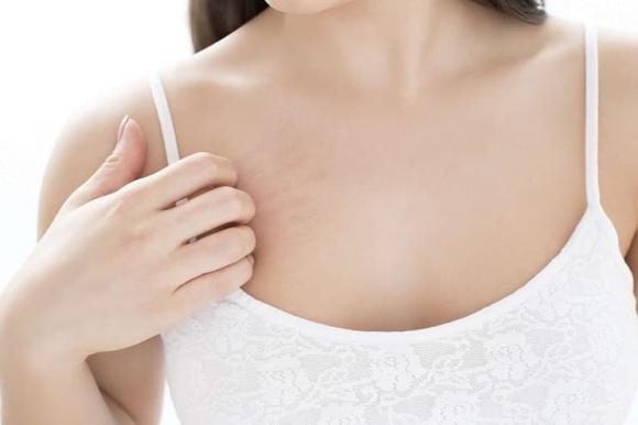 Ngứa dữ dội ở ngực có thể là tín hiệu sớm của nhiều loại bệnh, thậm chí tiến triển thành ung thư