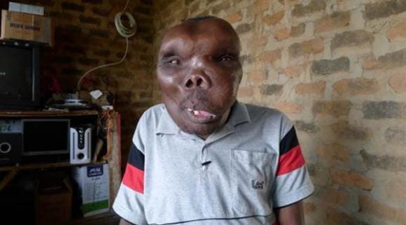 Baguma, Người đàn ông xấu xí nhất trên thế giới, ba vợ
