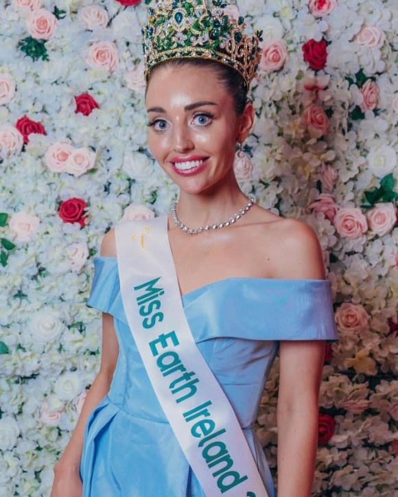 tân Hoa hậu Trái đất Ireland 2021, hoa hậu, nhan sắc bị chê