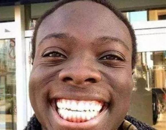 Người Châu Phi ít dùng kem đánh răng, tại sao răng họ vẫn trắng? Nó không  chỉ liên quan đến 'màu da đen'