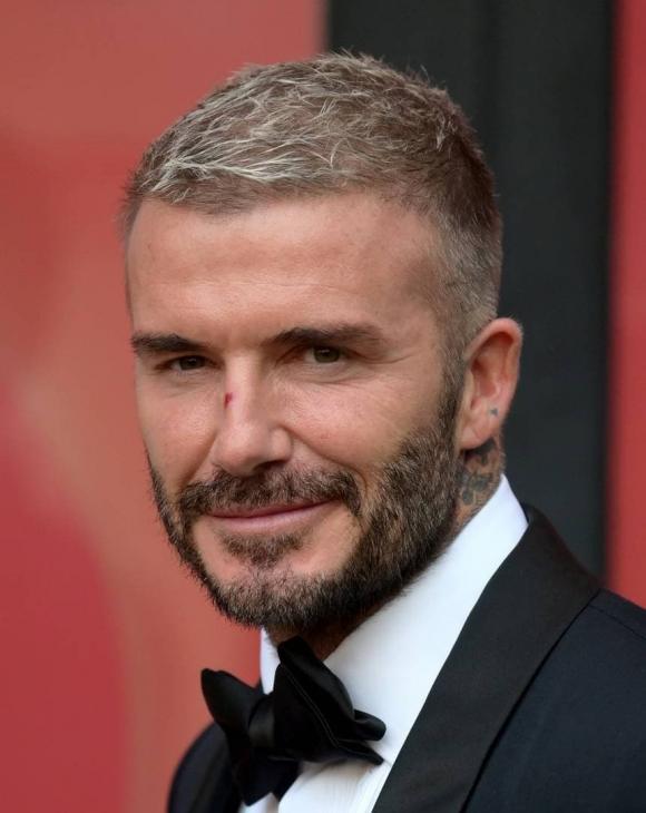 david beckham, victoria beckham, vết thương, sao hollywood