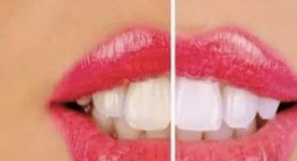 trắng răng, vàng răng, sạch răng, chăm sóc răng