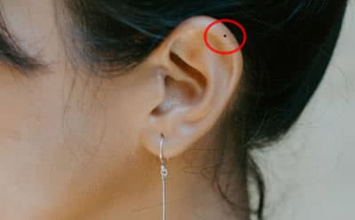 nốt ruồi, tướng số, phụ nữ có nốt ruồi tốt