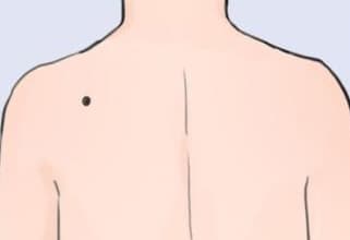 nốt ruồi, tướng số, phụ nữ có nốt ruồi tốt