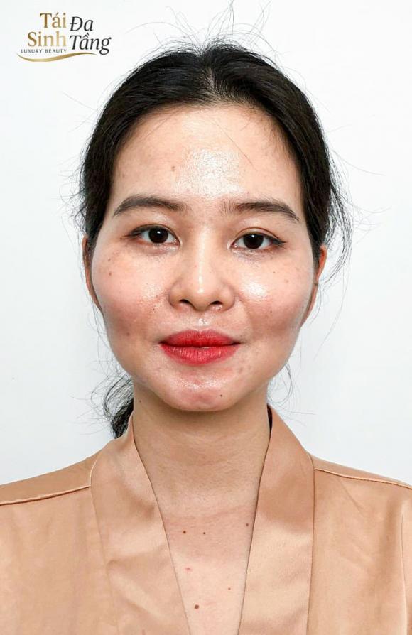 tai-sinh-da-tang-111-(1).jpg 0 Tái sinh đa tầng, Luxury Beauty, bí quyết làm đẹp