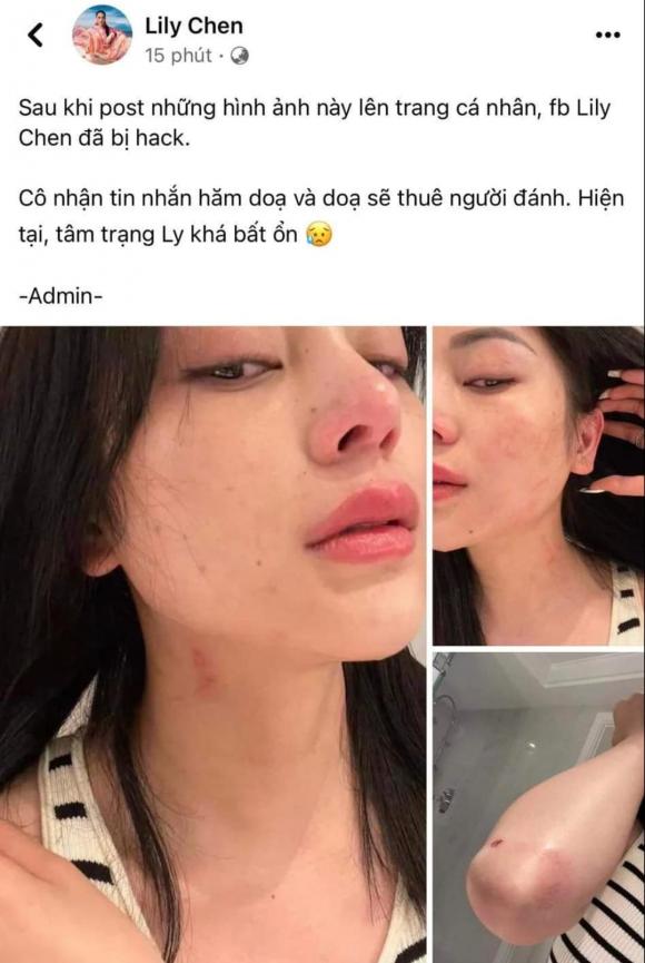 lily chen, ngọc trinh, sao việt 
