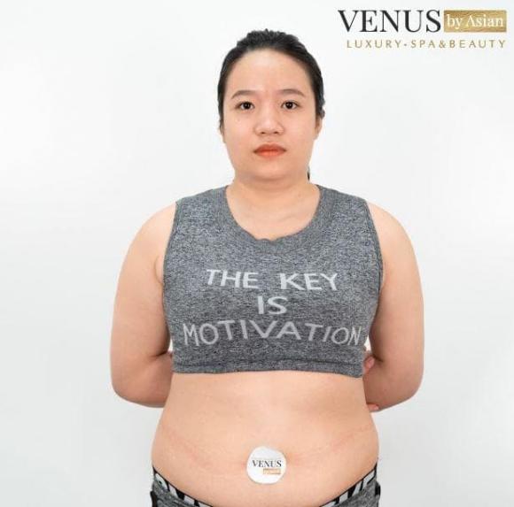 giam-beo-da-tang-2312 (1).jpg 0 Giảm béo đa tầng MaxBurning, Thẩm mỹ Venus by Asian, giảm cân