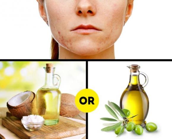chữa sẹo, mẹo chữa sẹo, cách giúp lành da 