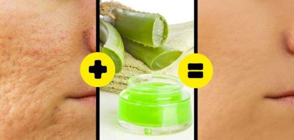 chữa sẹo, mẹo chữa sẹo, cách giúp lành da 