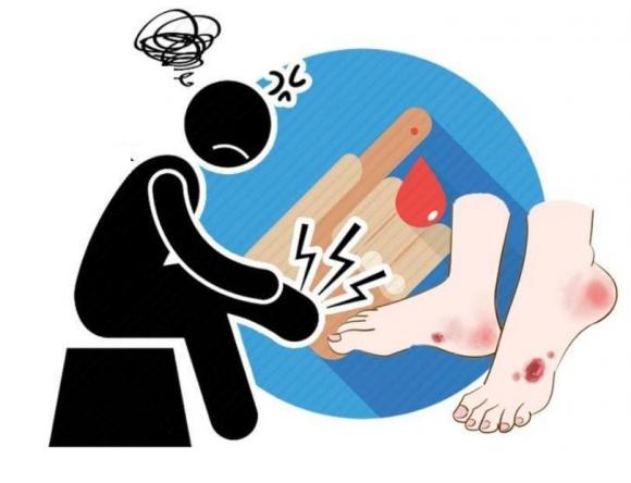 đường huyết cao, đường huyết, dấu hiệu đường huyết cao