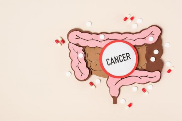 ung thư, ung thư có di truyền không, tính di truyền của ung thư