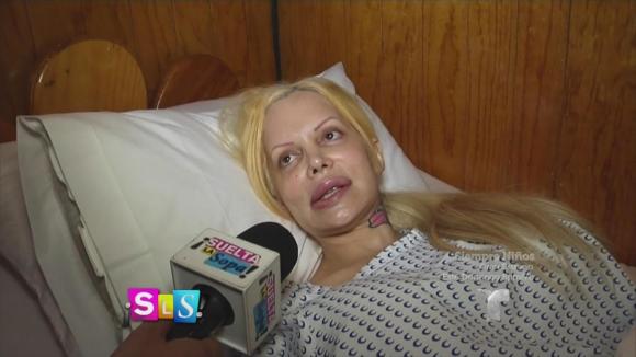 Argentina Sabrina Sabrok (Sabrina Sabrok), phẫu thuật thẩm mỹ, tê liệt mặt