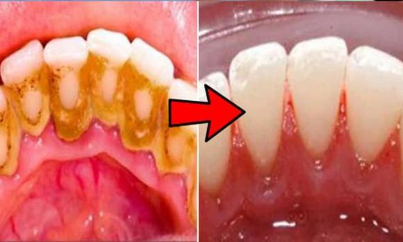 tỏi ky với thực phẩm, dạy nấu ăn, mẹo