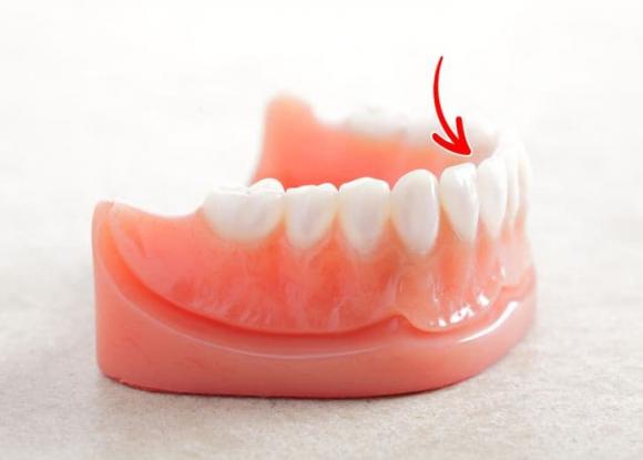 chăm sóc răng miệng, trắng răng, mẹo có hàm răng trắng sáng