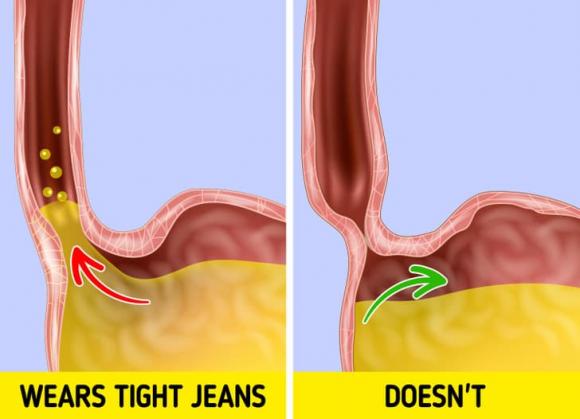 Quần jean, thời trang, mẹo vặt, Quần jean có hại cho sức khỏe