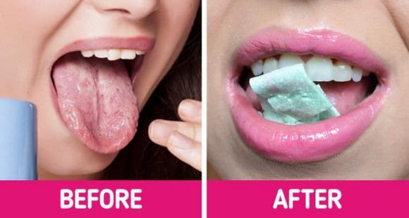 bỏng lưỡi, bỏng rát lưỡi, chữa lành vết bỏng rát lưỡi,
