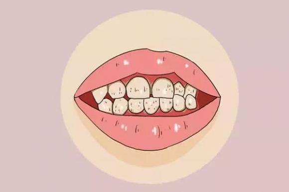 răng miêng, đốm răng, nha khoa