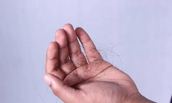 đàn ông hói đầu, đàn ông, đàn ông hói đầu thông minh hơn