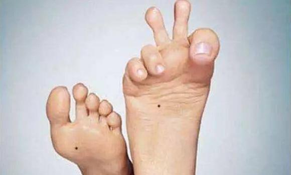 tướng số, tướng nốt ruồi xấu, nốt ruồi phá tài