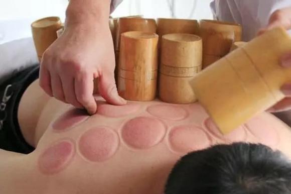giác hơi, sức khỏe