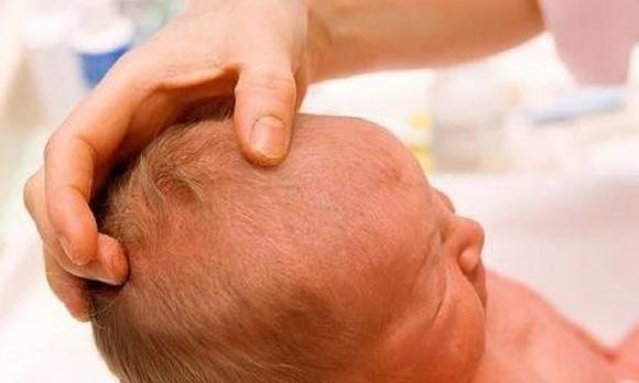 kẹo húng chanh, kẹo trị ho, cách làm kẹo trị ho