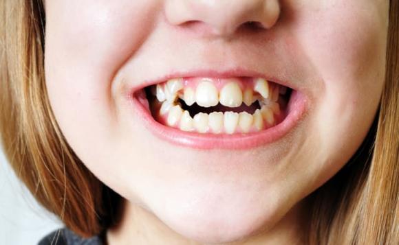 đặc điểm thừa hưởng từ cha mẹ, yếu tố thừa hưởng từ cha mẹ, kiến thức 