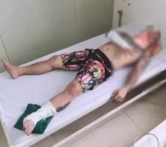 Hữu Công, Dương Minh Tuyền, Dương Minh Tuyền nhập viện 