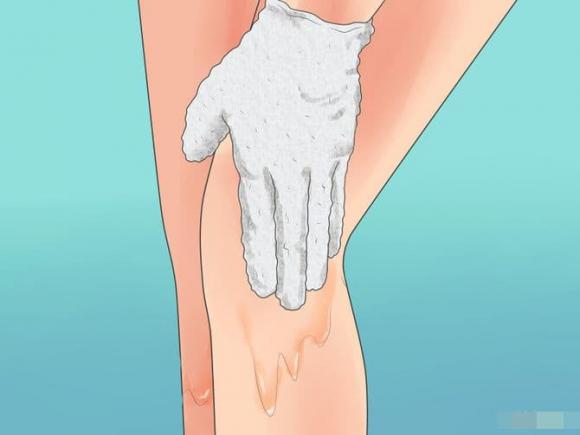 lông, lông mọc ngược, bệnh ngoài da