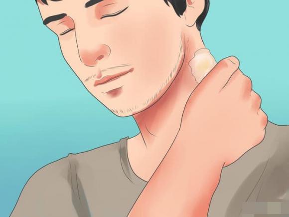 lông, lông mọc ngược, bệnh ngoài da