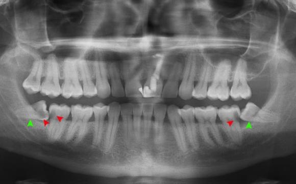 đặc điểm cơ thể, cơ thể, kiến thức 