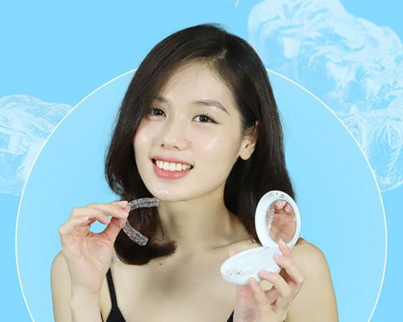 Niềng răng trong suốt bao lâu mang lại kết quả