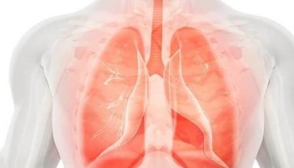 bệnh phổi, dấu hiệu bệnh phổi, các dấu hiệu bệnh phổi
