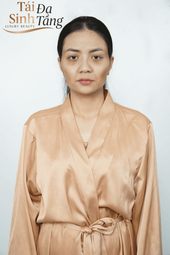tai-sinh-da-tang-203 (1).png 0 Tái sinh đa tầng, chăm da da, bí quyết làm đẹp,