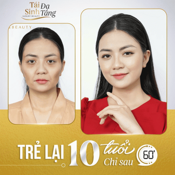 tai-sinh-da-tang-203 (1).png 0 Tái sinh đa tầng, chăm da da, bí quyết làm đẹp,
