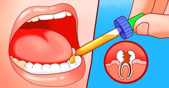 đau răng, cách chữa đau răng, đau răng phải làm sao, sức khỏe 