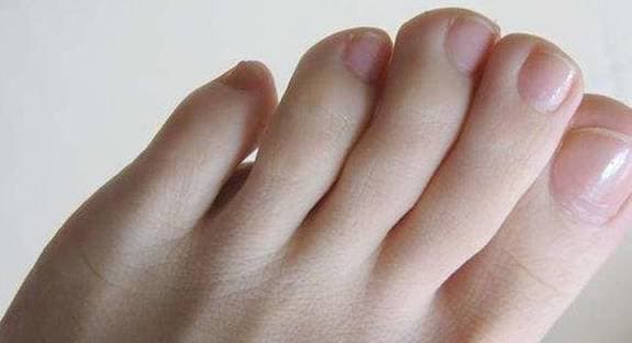 ung thư, dấu hiệu ung thư, thực phẩm tránh ung thư
